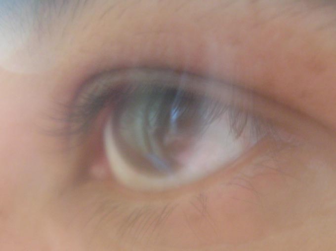 My eye (photograph by Mira)