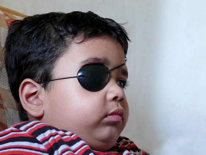 Manu wearing an eye patch , copyright Picturejockey : Navin Harish 2005-2009