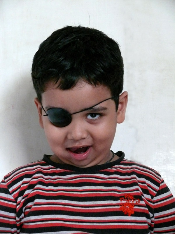 Manu wearing an eye patch , copyright Picturejockey : Navin Harish 2005-2009