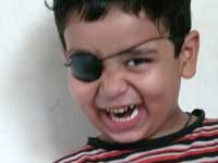 A smiling pirate - Manu wearing an eye patch