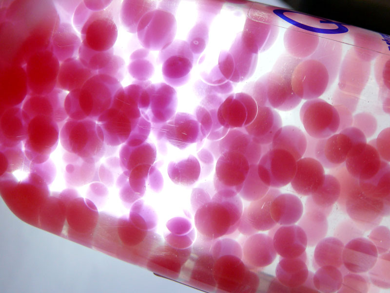 More blood cells, copyright Picturejockey : Navin Harish 2005-2009